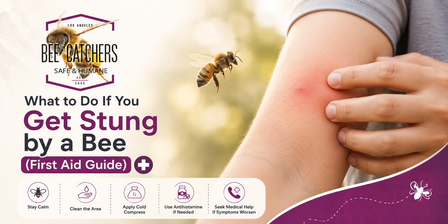 What to Do If You Get Stung by a Bee